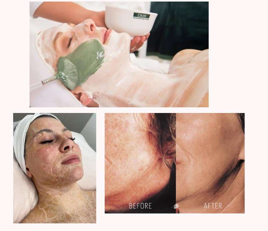 Buccal Massage Los Angeles
